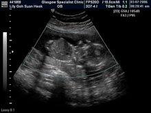Vivian Sonograms